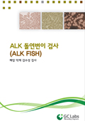 ALK 돌연변이 검사