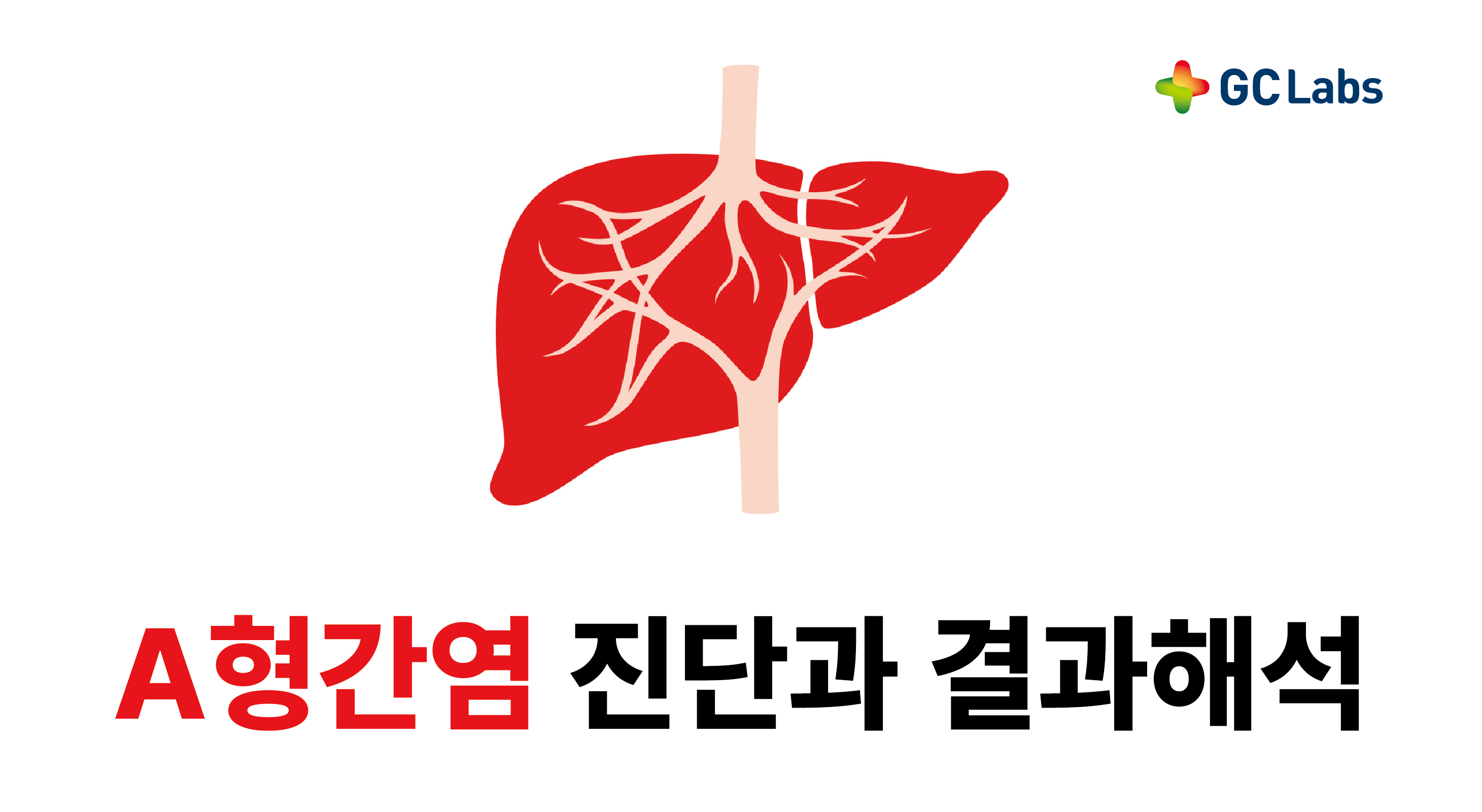 A형 간염 특징, 증상, 검사결과 해석
